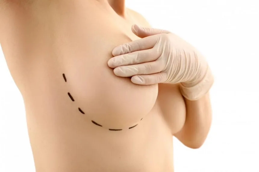 Powiększanie piersi metodą wibracji próżniowej - zalety i wady